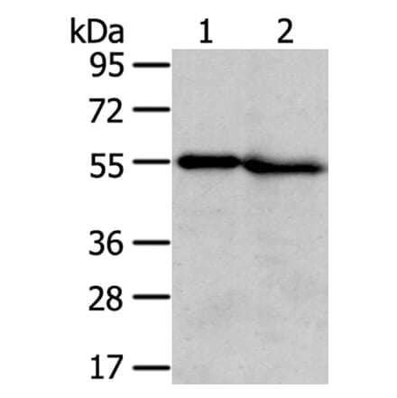 TMPRSS5 Antibody from Signalway Antibody (40345) - Antibodies.com