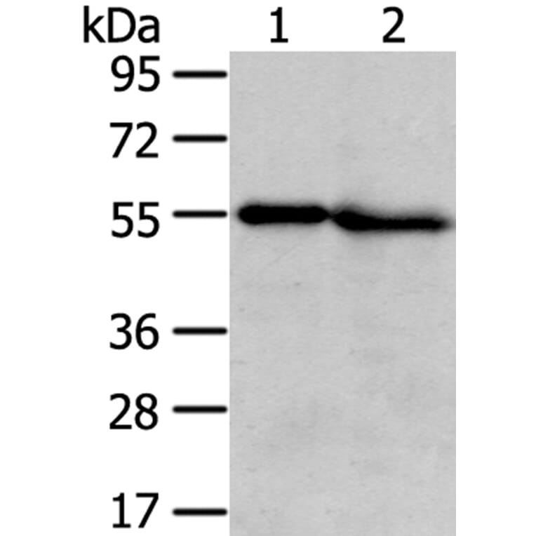 TMPRSS5 Antibody from Signalway Antibody (40345) - Antibodies.com