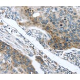 Immunohistochemistry - TMPRSS5 Antibody from Signalway Antibody (40345) - Antibodies.com