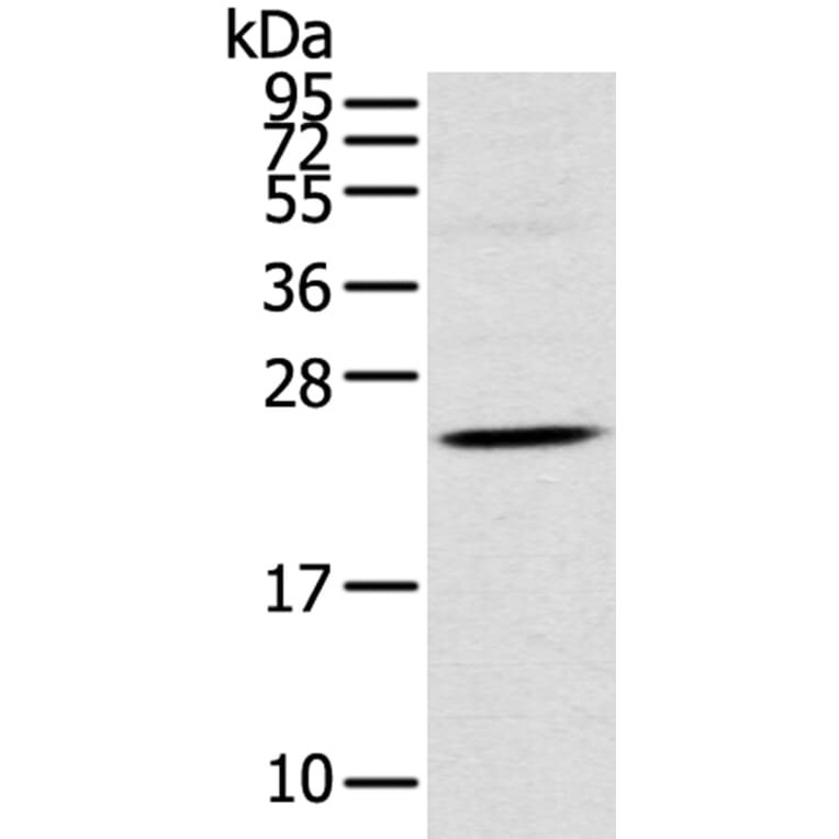 TSPAN13 Antibody from Signalway Antibody (40384) - Antibodies.com