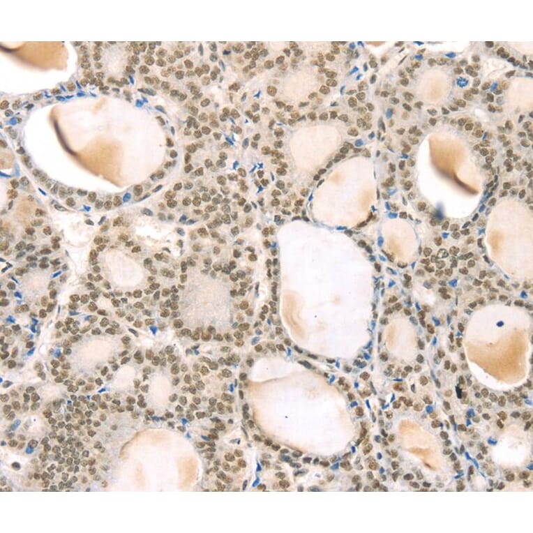 Immunohistochemistry - TSPAN13 Antibody from Signalway Antibody (40384) - Antibodies.com