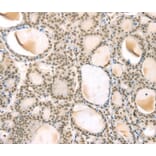 Immunohistochemistry - TSPAN13 Antibody from Signalway Antibody (40384) - Antibodies.com