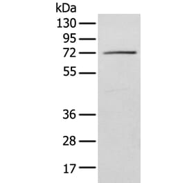 IGF2BP3 Antibody from Signalway Antibody (42708) - Antibodies.com