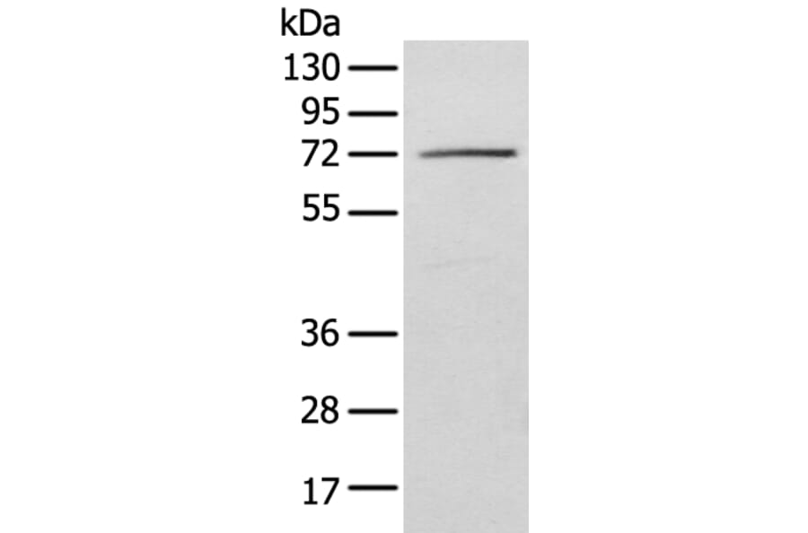 IGF2BP3 Antibody from Signalway Antibody (42708) - Antibodies.com