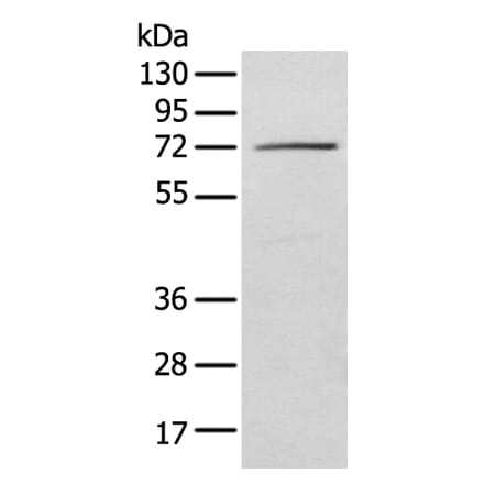 IGF2BP3 Antibody from Signalway Antibody (42708) - Antibodies.com