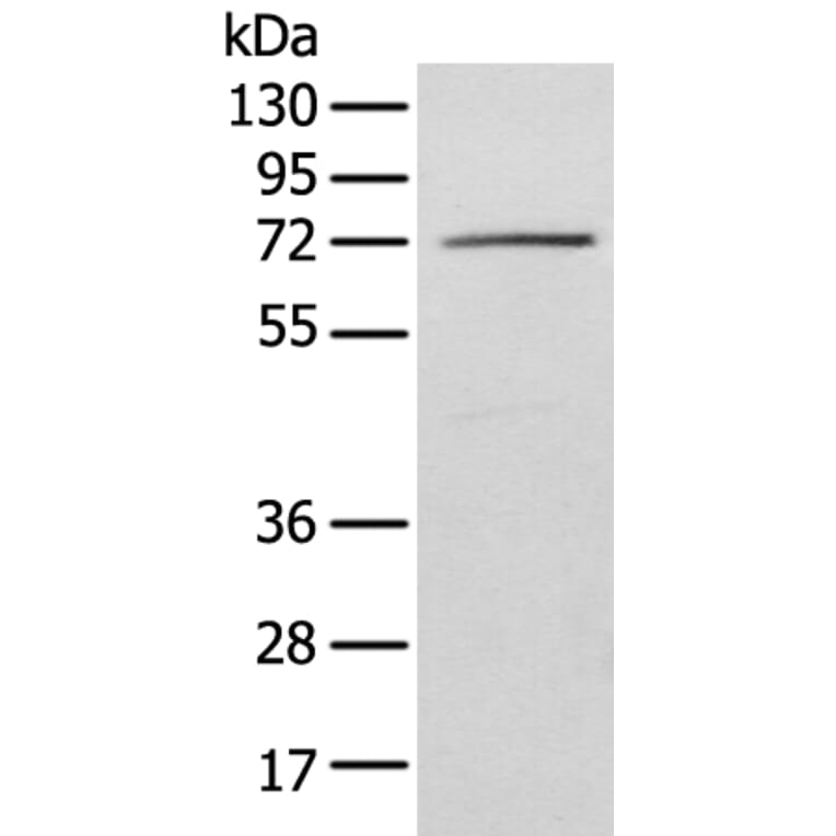 IGF2BP3 Antibody from Signalway Antibody (42708) - Antibodies.com