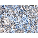 Immunohistochemistry - IGF2BP3 Antibody from Signalway Antibody (42708) - Antibodies.com