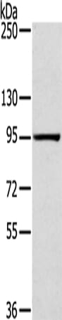 Gel: 6%SDS-PAGE Lysate: 40 &#956;g Lane: PC3 cells Primary antibody: 1/200 dilution Secondary antibody: Goat anti rabbit IgG at 1/8000 dilution Exposure time: 3 minutes