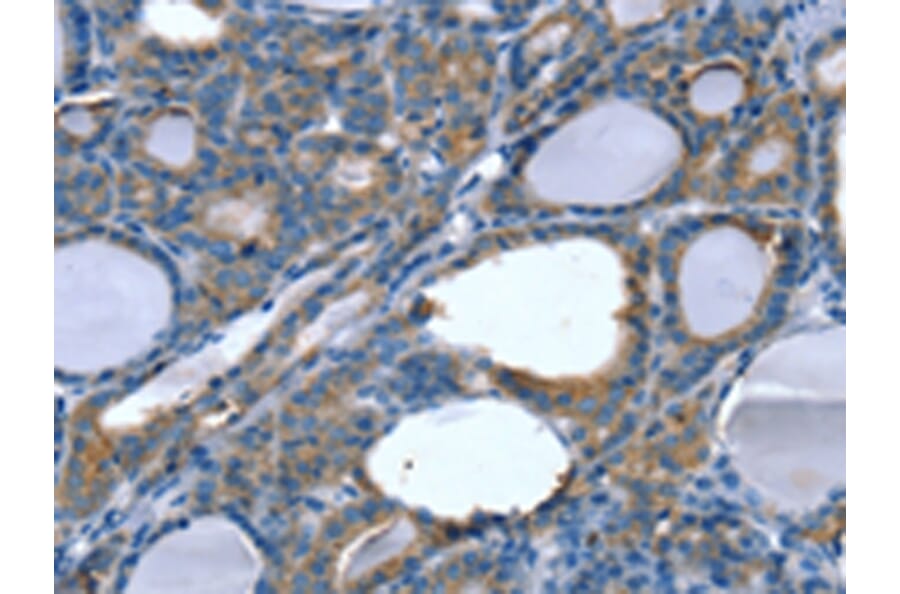 Immunohistochemistry - SLITRK4 Antibody from Signalway Antibody (42759) - Antibodies.com