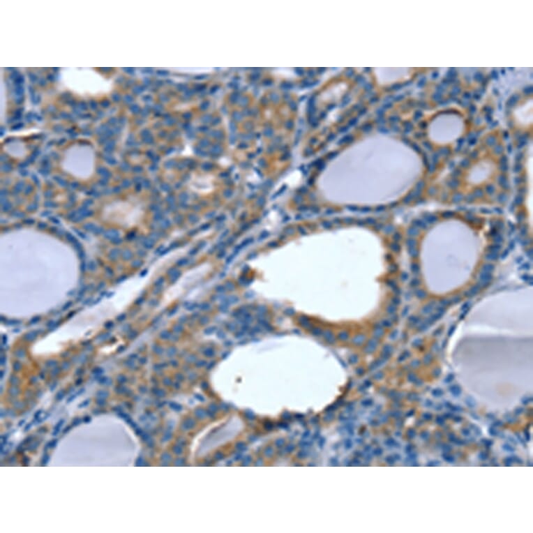 Immunohistochemistry - SLITRK4 Antibody from Signalway Antibody (42759) - Antibodies.com