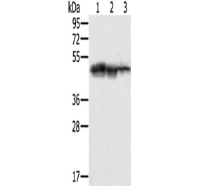 SMARCB1 Antibody from Signalway Antibody (42763) - Antibodies.com