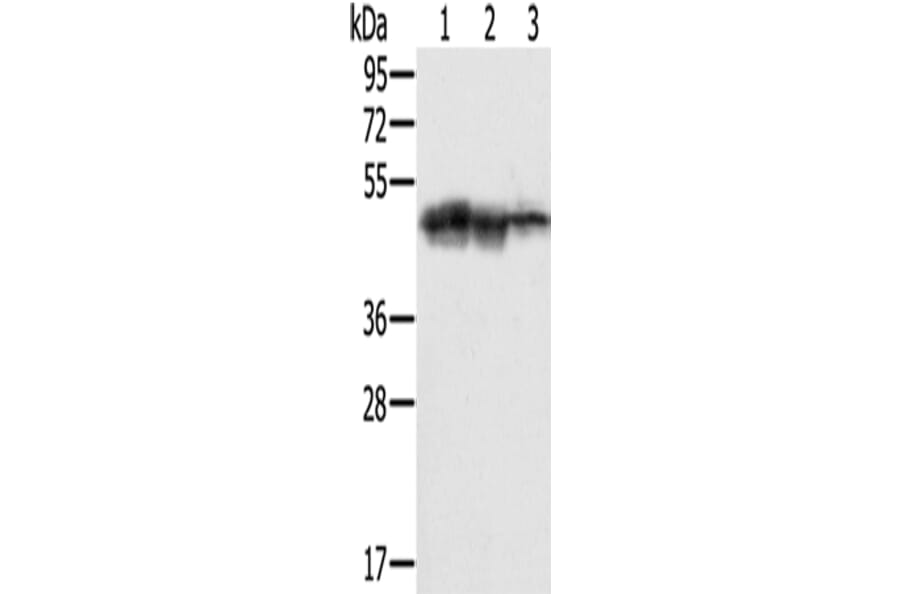 SMARCB1 Antibody from Signalway Antibody (42763) - Antibodies.com
