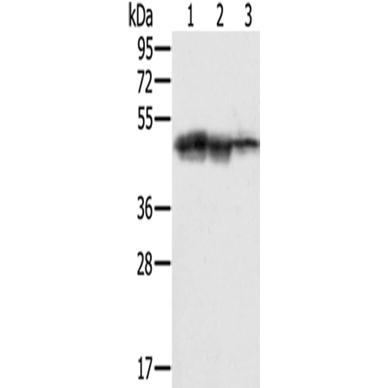 SMARCB1 Antibody from Signalway Antibody (42763) - Antibodies.com