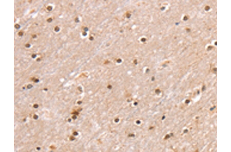 Immunohistochemistry - SMARCB1 Antibody from Signalway Antibody (42763) - Antibodies.com