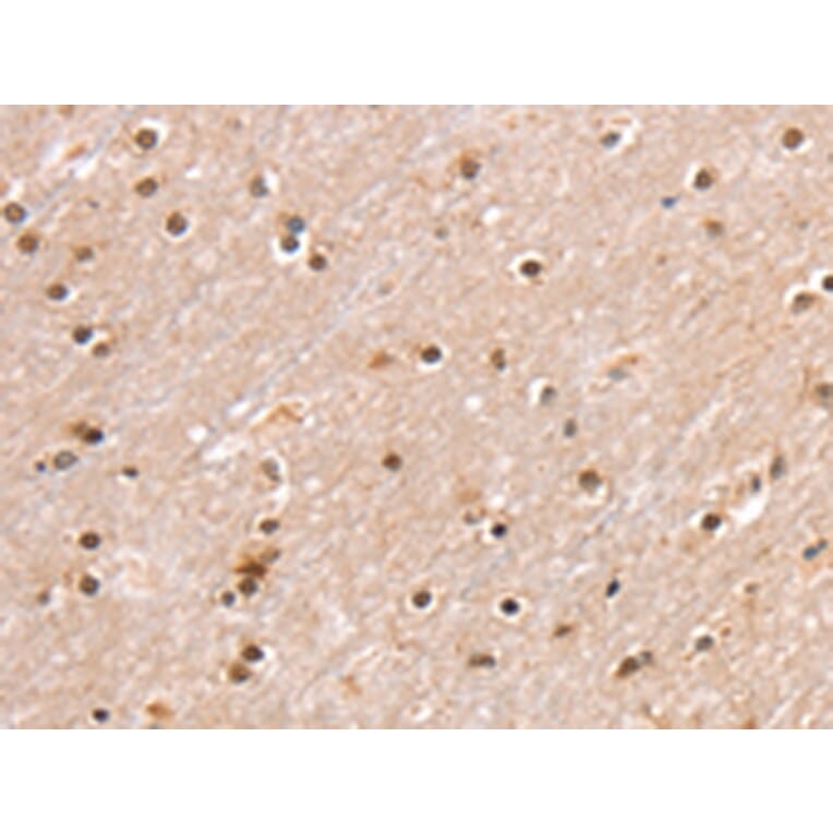 Immunohistochemistry - SMARCB1 Antibody from Signalway Antibody (42763) - Antibodies.com