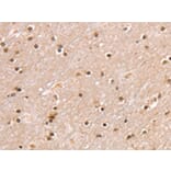 Immunohistochemistry - SMARCB1 Antibody from Signalway Antibody (42763) - Antibodies.com