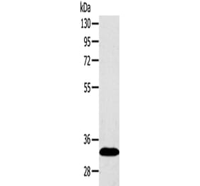 SULT2A1 Antibody from Signalway Antibody (42769) - Antibodies.com