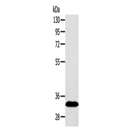 SULT2A1 Antibody from Signalway Antibody (42769) - Antibodies.com