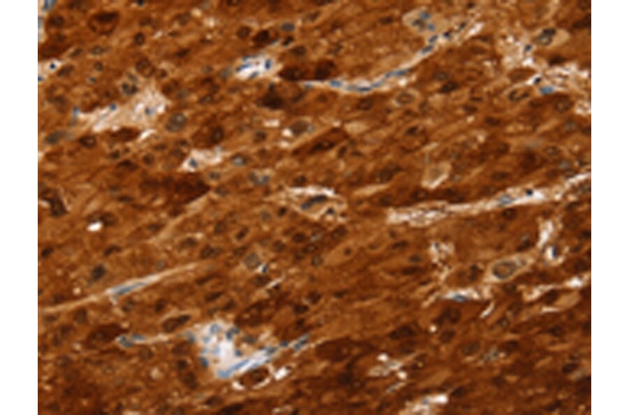 Immunohistochemistry - SULT2A1 Antibody from Signalway Antibody (42769) - Antibodies.com