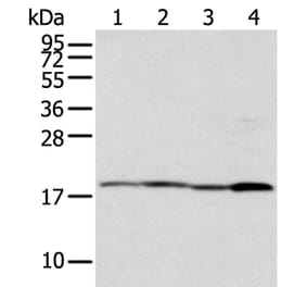 TIMM17A Antibody from Signalway Antibody (42782) - Antibodies.com