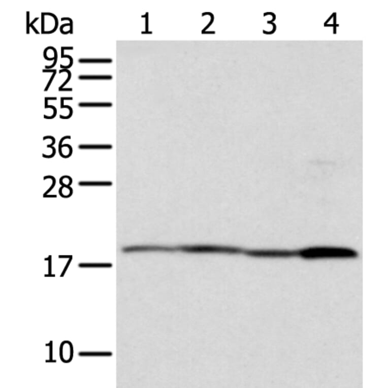 TIMM17A Antibody from Signalway Antibody (42782) - Antibodies.com