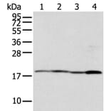TIMM17A Antibody from Signalway Antibody (42782) - Antibodies.com