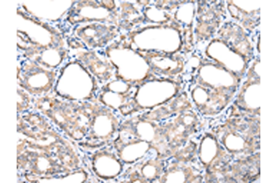 Immunohistochemistry - TIMM17A Antibody from Signalway Antibody (42782) - Antibodies.com