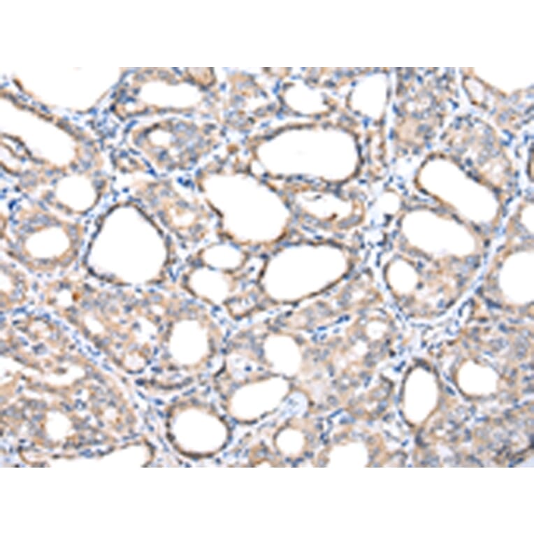Immunohistochemistry - TIMM17A Antibody from Signalway Antibody (42782) - Antibodies.com