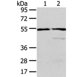 ALDH3A2 Antibody from Signalway Antibody (42809) - Antibodies.com