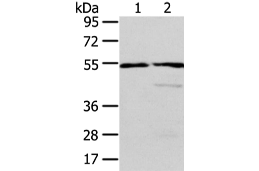 ALDH3A2 Antibody from Signalway Antibody (42809) - Antibodies.com