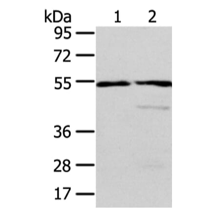 ALDH3A2 Antibody from Signalway Antibody (42809) - Antibodies.com