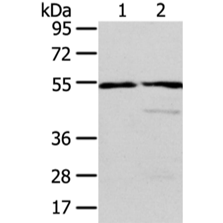 ALDH3A2 Antibody from Signalway Antibody (42809) - Antibodies.com