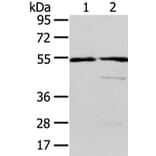 ALDH3A2 Antibody from Signalway Antibody (42809) - Antibodies.com