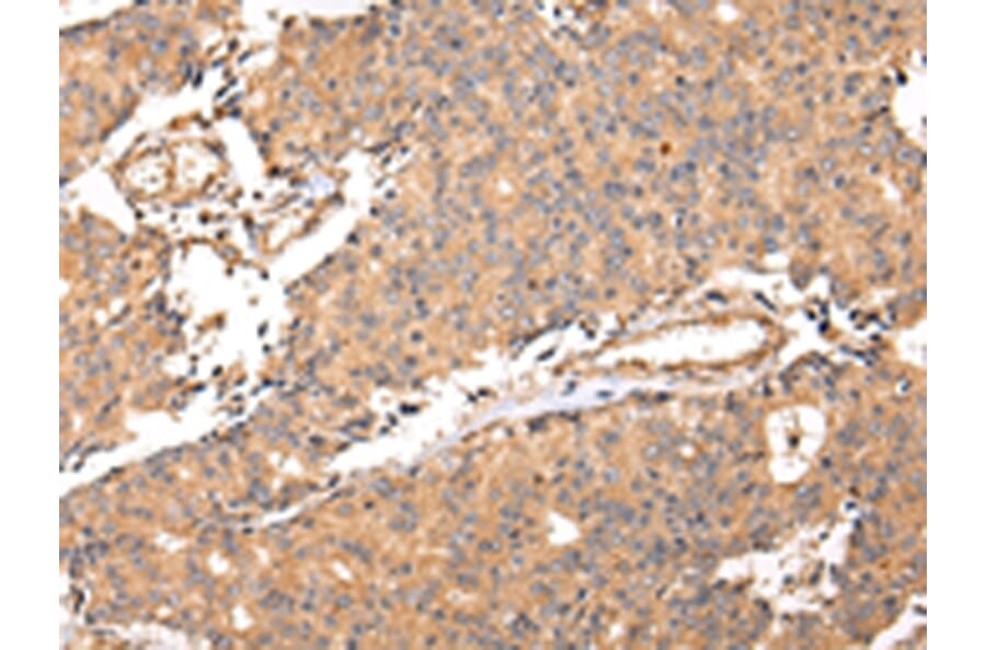Immunohistochemistry - ALDH3A2 Antibody from Signalway Antibody (42809) - Antibodies.com