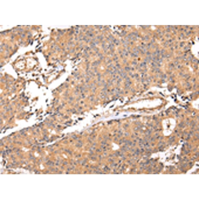 Immunohistochemistry - ALDH3A2 Antibody from Signalway Antibody (42809) - Antibodies.com