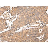 Immunohistochemistry - ALDH3A2 Antibody from Signalway Antibody (42809) - Antibodies.com