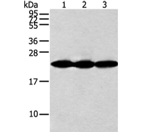 NDUFB10 Antibody from Signalway Antibody (42881) - Antibodies.com
