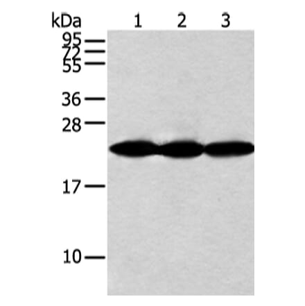 NDUFB10 Antibody from Signalway Antibody (42881) - Antibodies.com