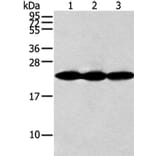 NDUFB10 Antibody from Signalway Antibody (42881) - Antibodies.com