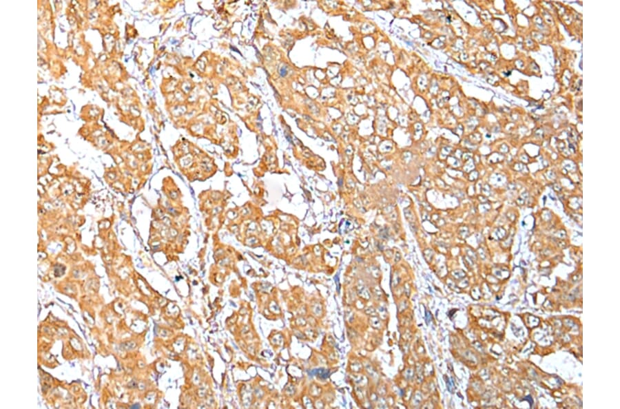 Immunohistochemistry - NDUFB10 Antibody from Signalway Antibody (42881) - Antibodies.com