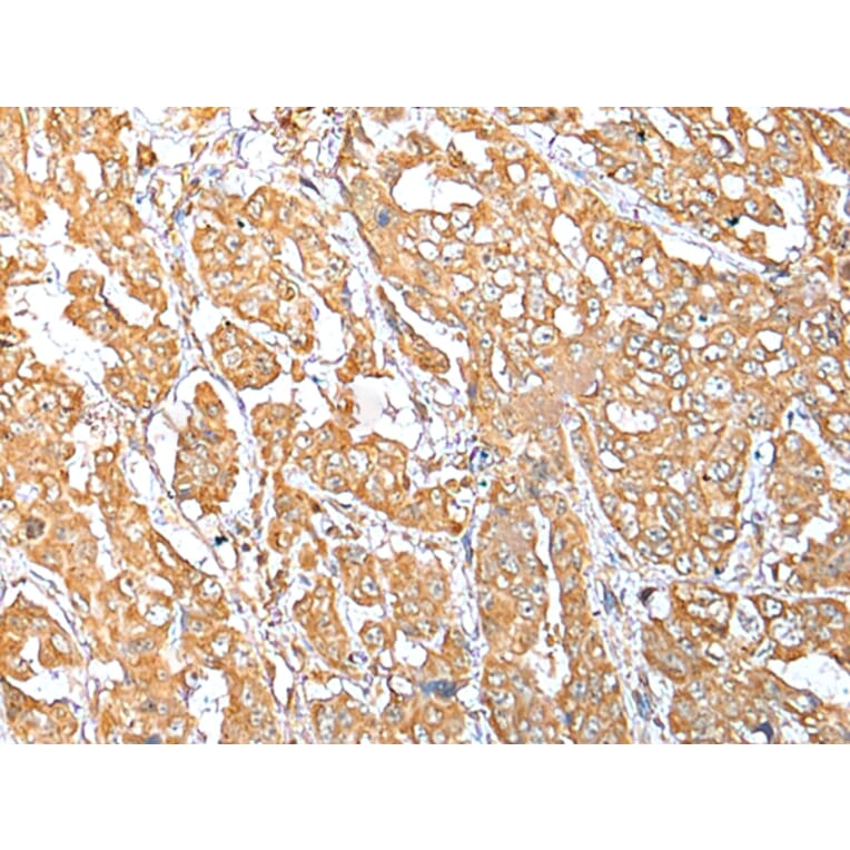 Immunohistochemistry - NDUFB10 Antibody from Signalway Antibody (42881) - Antibodies.com