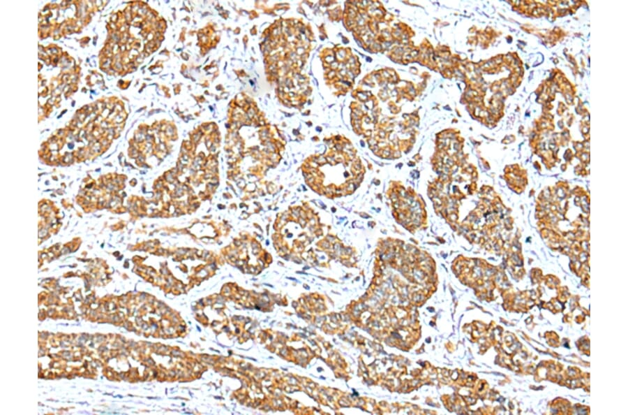 Immunohistochemistry - NDUFB10 Antibody from Signalway Antibody (42881) - Antibodies.com