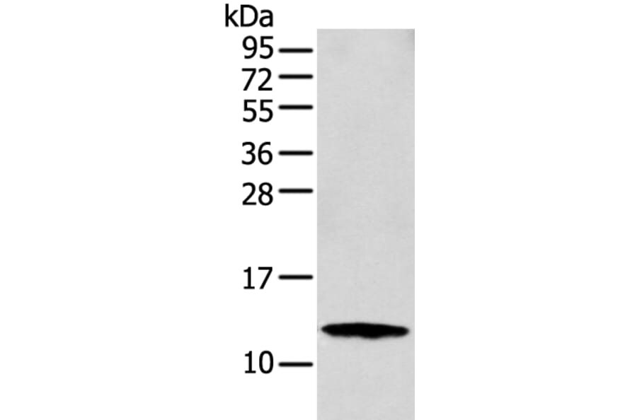 S100A16 Antibody from Signalway Antibody (42896) - Antibodies.com