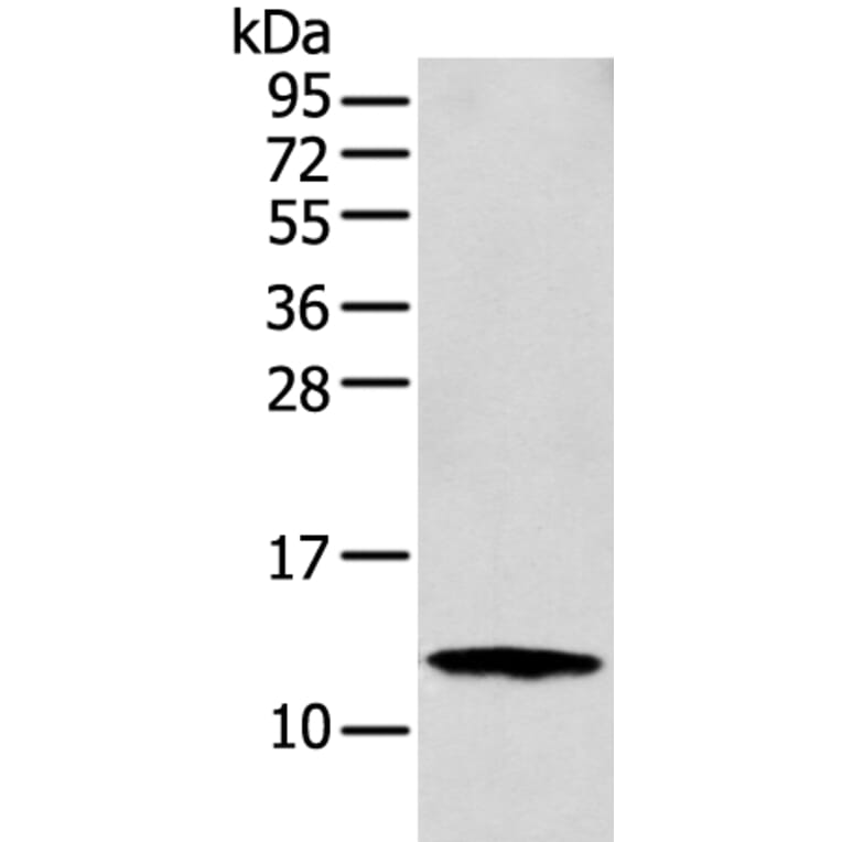 S100A16 Antibody from Signalway Antibody (42896) - Antibodies.com