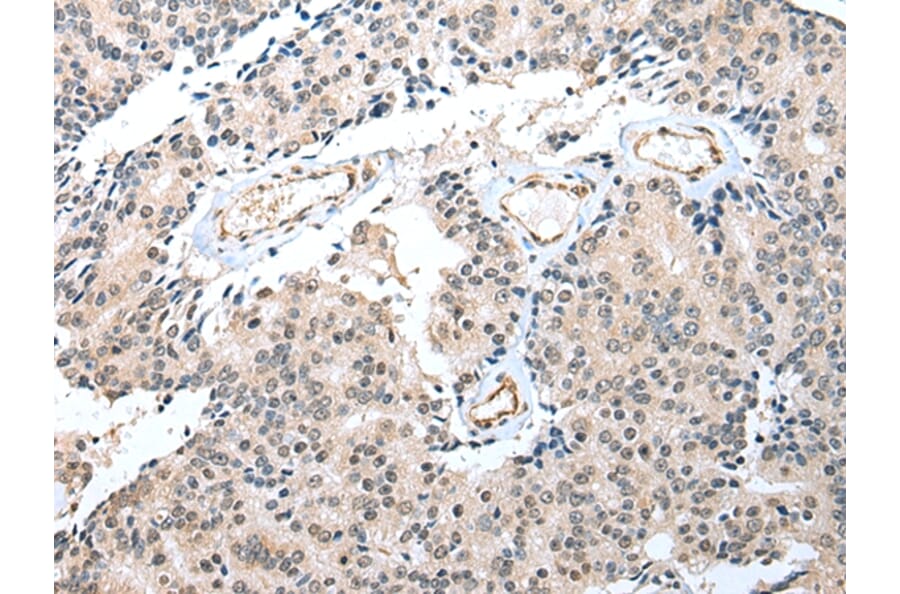 Immunohistochemistry - S100A16 Antibody from Signalway Antibody (42896) - Antibodies.com