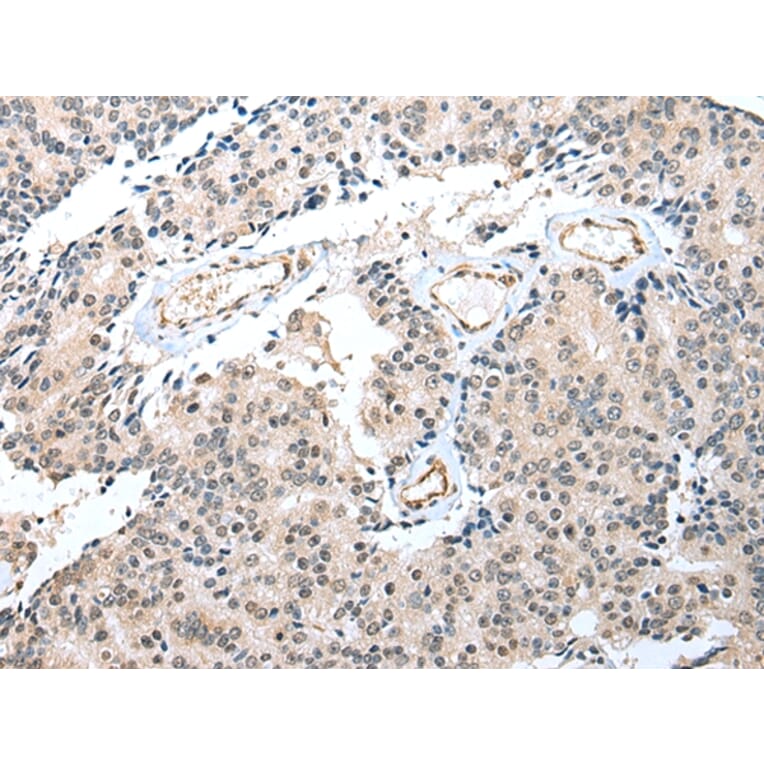 Immunohistochemistry - S100A16 Antibody from Signalway Antibody (42896) - Antibodies.com