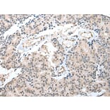 Immunohistochemistry - S100A16 Antibody from Signalway Antibody (42896) - Antibodies.com