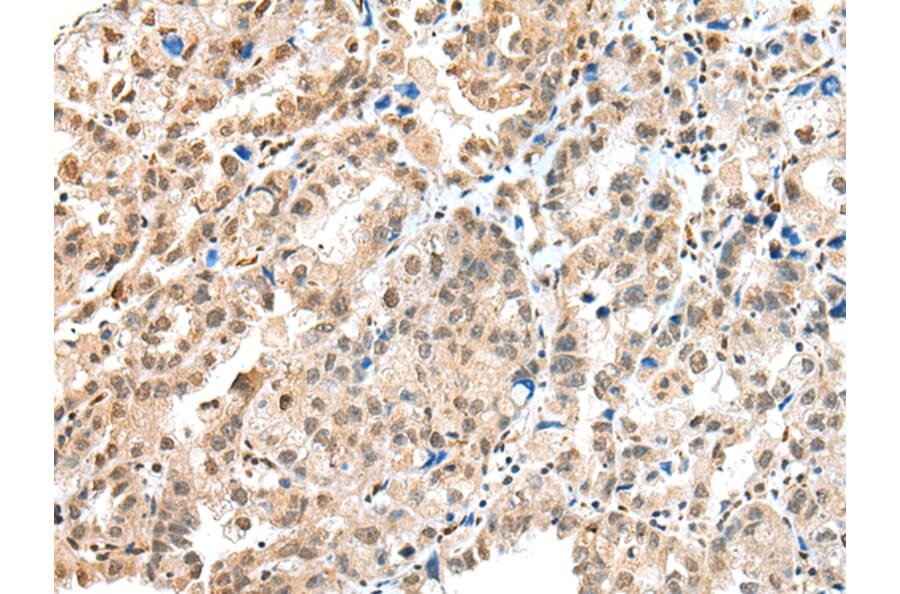 Immunohistochemistry - S100A16 Antibody from Signalway Antibody (42896) - Antibodies.com