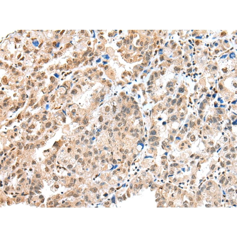 Immunohistochemistry - S100A16 Antibody from Signalway Antibody (42896) - Antibodies.com