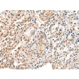 Immunohistochemistry - S100A16 Antibody from Signalway Antibody (42896) - Antibodies.com